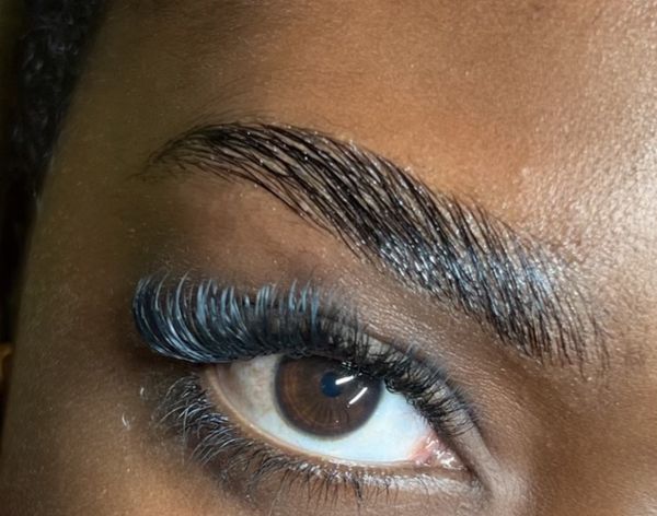 Brow lift après