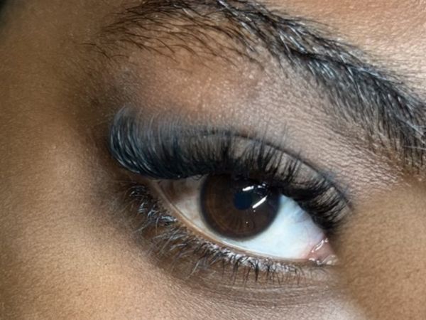 Brow lift avant